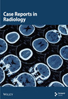 Case Reports in Radiology