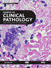 JOURNAL OF CLINICAL PATHOLOGY