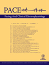 PACE-PACING AND CLINICAL ELECTROPHYSIOLOGY