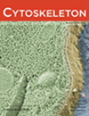 CELL MOTILITY AND THE CYTOSKELETON
